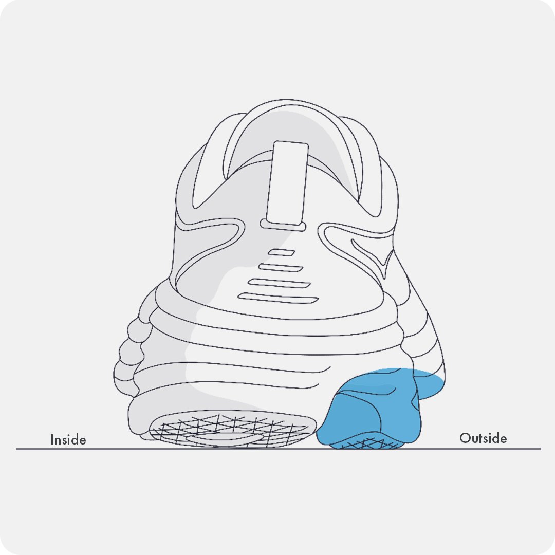 UNDERPRONATION