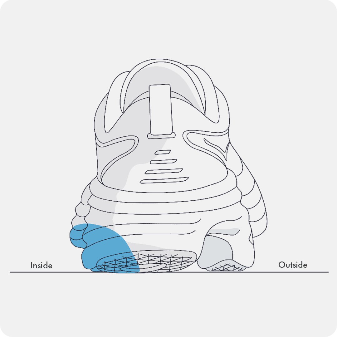 OVERPRONATION